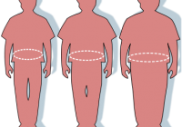 376px-Obesity-waist_circumference.svg