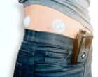 close up of a female diabetic patient with infusion insulin pump connected on the belly – medical device with wireless transmission technology – health care concept