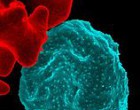 Red_blood_cell_infected_with_malaria_parasites-NIAID_RML