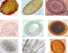 Collage_of_various_helminth_eggs