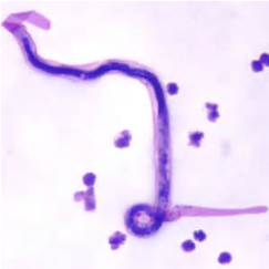 Brugia malayi microfilariae. Source: Centre for Disease Control.