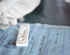 Malaria Rapid diagnostic test