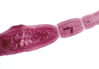 Echinococcus-multilocularis-adult