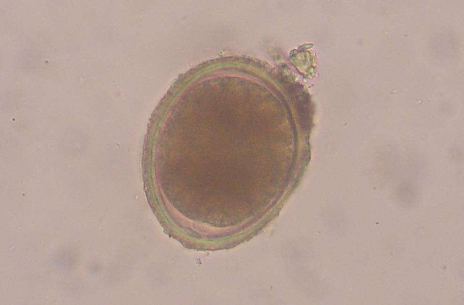 A feline roundworm (Toxocara cati) egg. Photo taken through a microscope at 400x. Photo Credit Joel Mills under Creative Commons licence.
