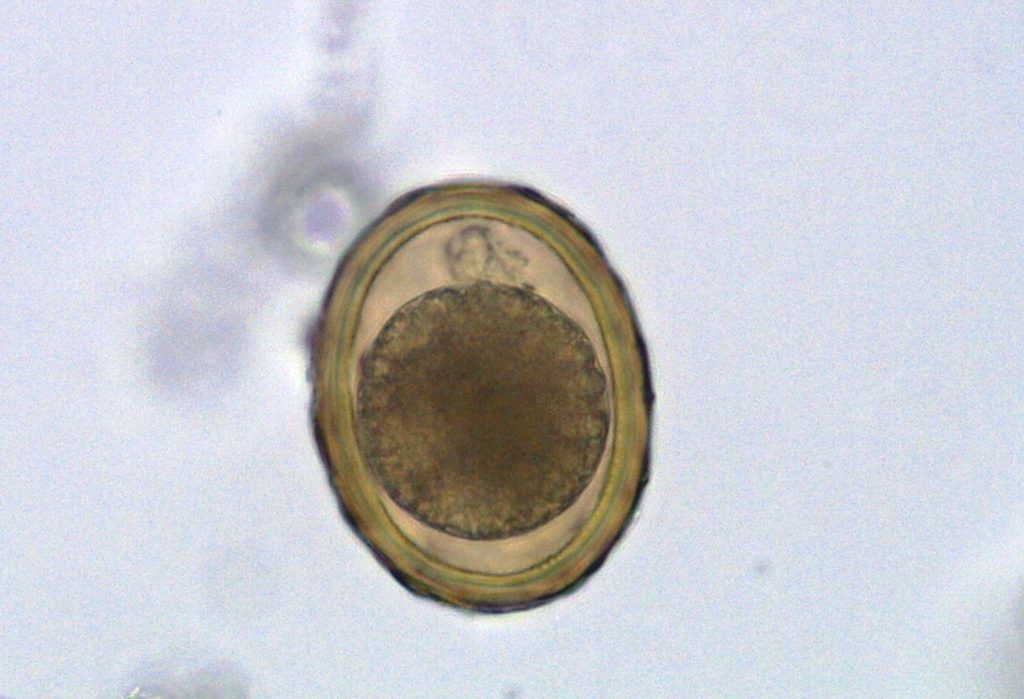 Undeveloped Ascaris sp. egg - This was extracted from faecal samples provided by sanitation and non-sanitation workers. The eggs were stored in physiological saline. This is a one-celled stage. SuSanA Secretariat