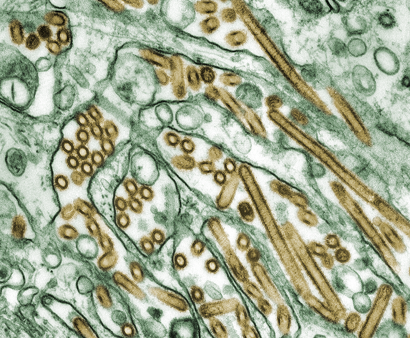 Colorized transmission electron micrograph of avian influenza A H5N1 (seen in gold) grown in MDCK cells (seen in green)