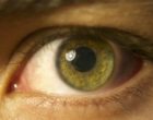 Could retinal inflammation become a biomarker of  seizure burden?