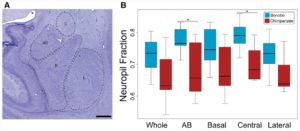 Issa et al. figure - a comparison of the proportion of neuropils (structural, connective elements of the brain) between Bonobos and Chimpanzees, alongside a microscopic image of the amygdala nuclei located in the brain)