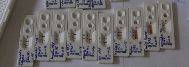 Malaria rapid diagnostic tests (RDT) on a random morning, the ones with two bands are positive.