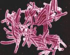 Mycobacterium tuberculosis bacteria, the cause of TB.
Source: https://www.flickr.com/photos/niaid/5149398656