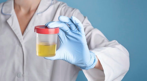 Doctor in a laboratory coat and blue medical gloves holding a container for urine analysis