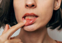bleeding gum girl © Maksym Povozniuk stock.adobe.com